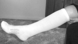 stocking up till knee